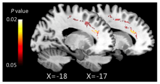 Медитация и бизнес